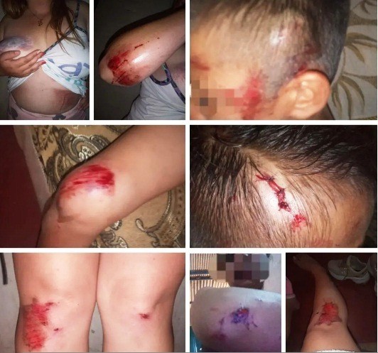 Diario Frontera, Frontera Digital,  ROBO Y ATAQUE A PERSONAS, LA AZULITA, MÉRIDA, Sucesos, ,Cuatro personas desconocidas agredieron a dos ciudadanas 
y dos niños por resistirse al robo en La Azulita