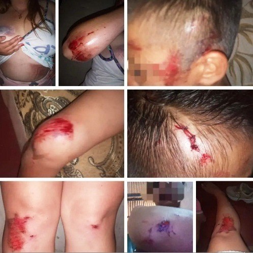 Diario Frontera, Frontera Digital,  ROBO Y ATAQUE A PERSONAS, LA AZULITA, MÉRIDA, Sucesos, ,Cuatro personas desconocidas agredieron a dos ciudadanas 
y dos niños por resistirse al robo en La Azulita