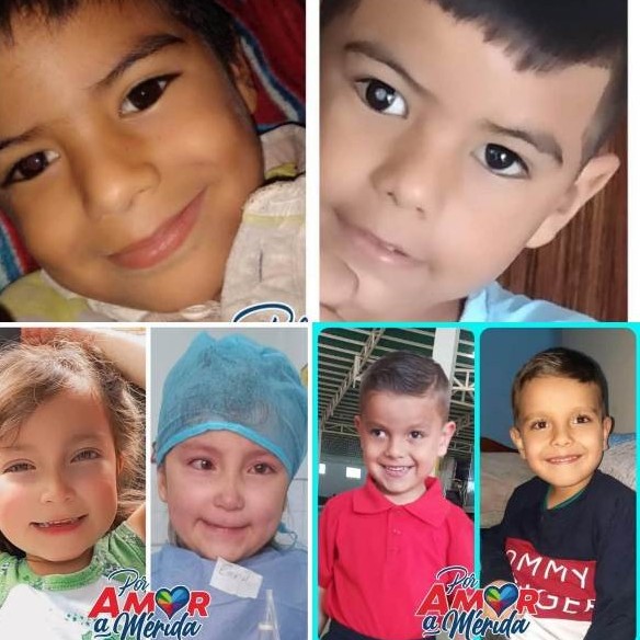 Diario Frontera, Frontera Digital,  intervenciones oftalmológicas en el Iahula, GOBIERNO DE MÉRIDA, FUNDACIÒN NIÑO SIMÓN, Salud, ,Más de 28 infantes merideños 
recibieron intervenciones oftalmológicas en el Iahula