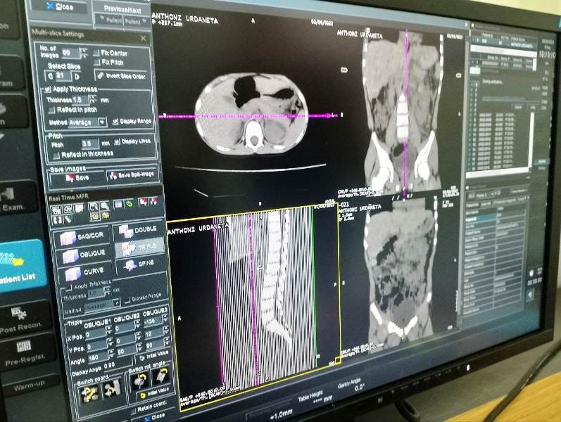 Diario Frontera, Frontera Digital,  TOMÓGRAFO INICIA OPERACIONES, IAHULA, GOBIERNO DE MÉRIDA, JEHYSON GUZMÁN, Salud, ,Tomógrafo del Iahula inicia operaciones para beneficio del pueblo merideño