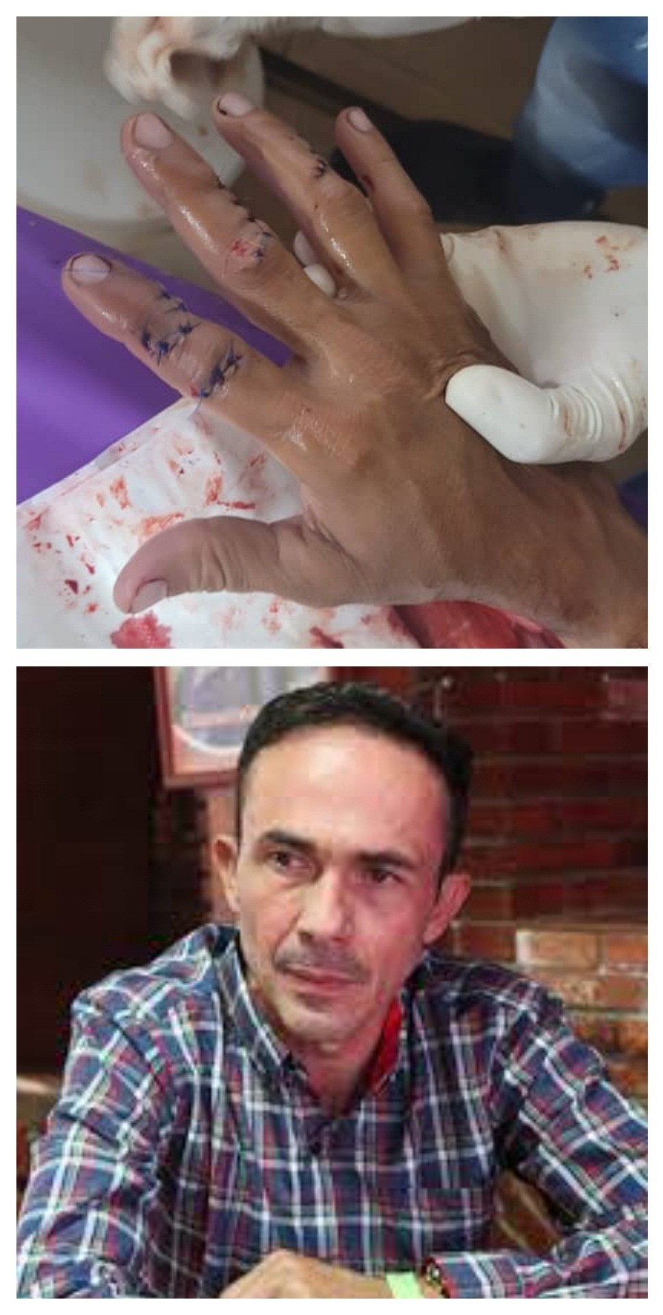 Diario Frontera, Frontera Digital,  CARLOS MAYA, Sucesos, ,Carlos Maya se recupera de la agresión 
al resistirse a ser atracado en El Vigía