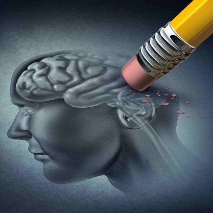 Diario Frontera, Frontera Digital,  Alzheimer en Venezuela, Salud, ,200.000 personas son diagnosticadas 
con Alzheimer en Venezuela cada año