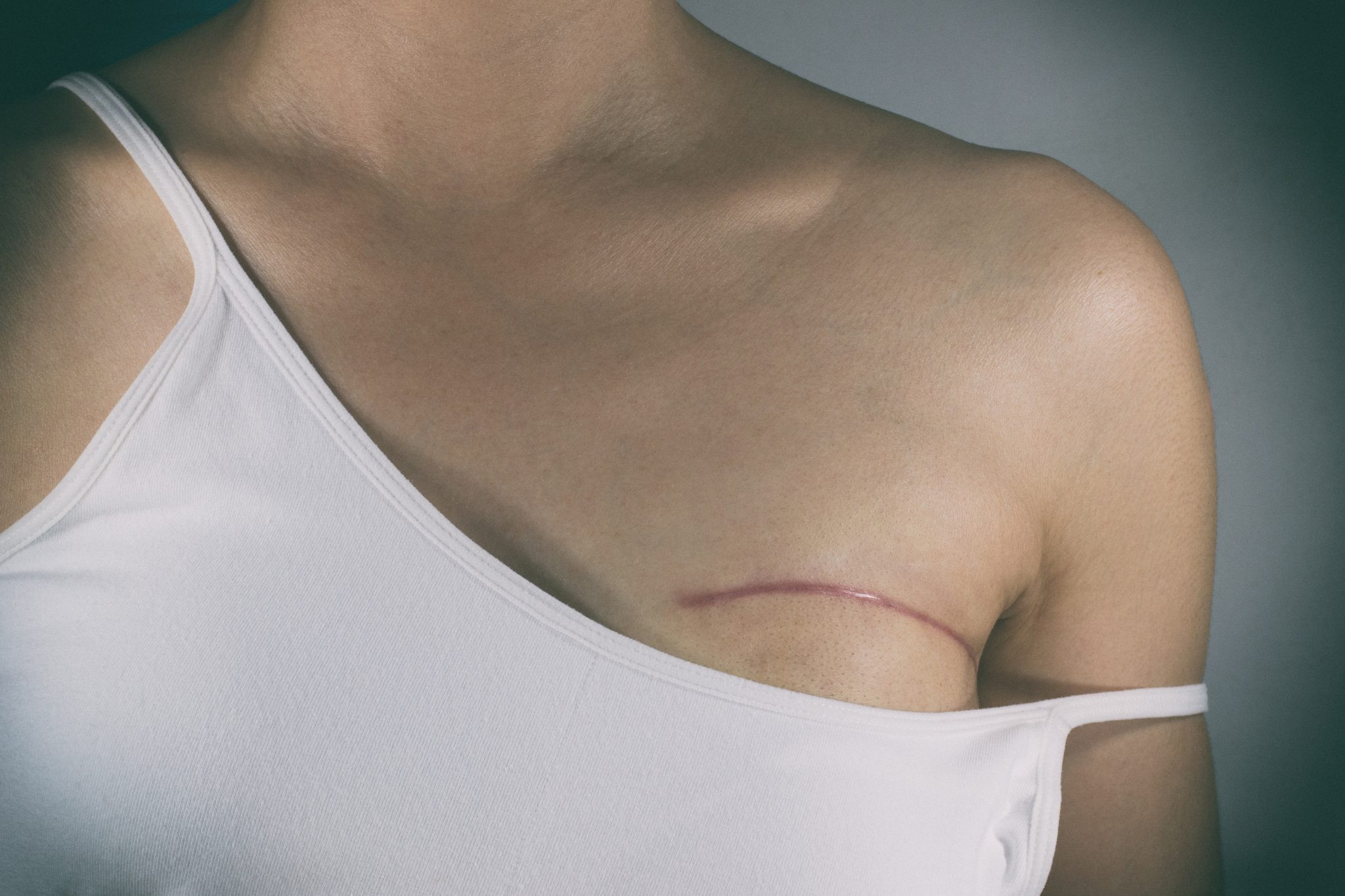 Diario Frontera, Frontera Digital,  Nacionales, Salud, ,Diez mujeres fallecen todos los días en Venezuela por diagnósticos tardíos de cáncer de mama