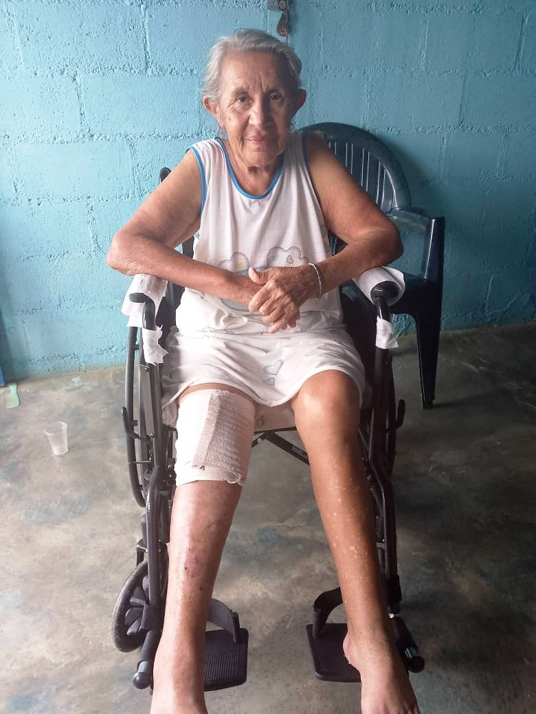 Diario Frontera, Frontera Digital,  El Vigía Panamericana, ,Nancy Roa beneficiada con una silla de rueda 
por la Comisión de Ayuda Rotaria de El Vigía