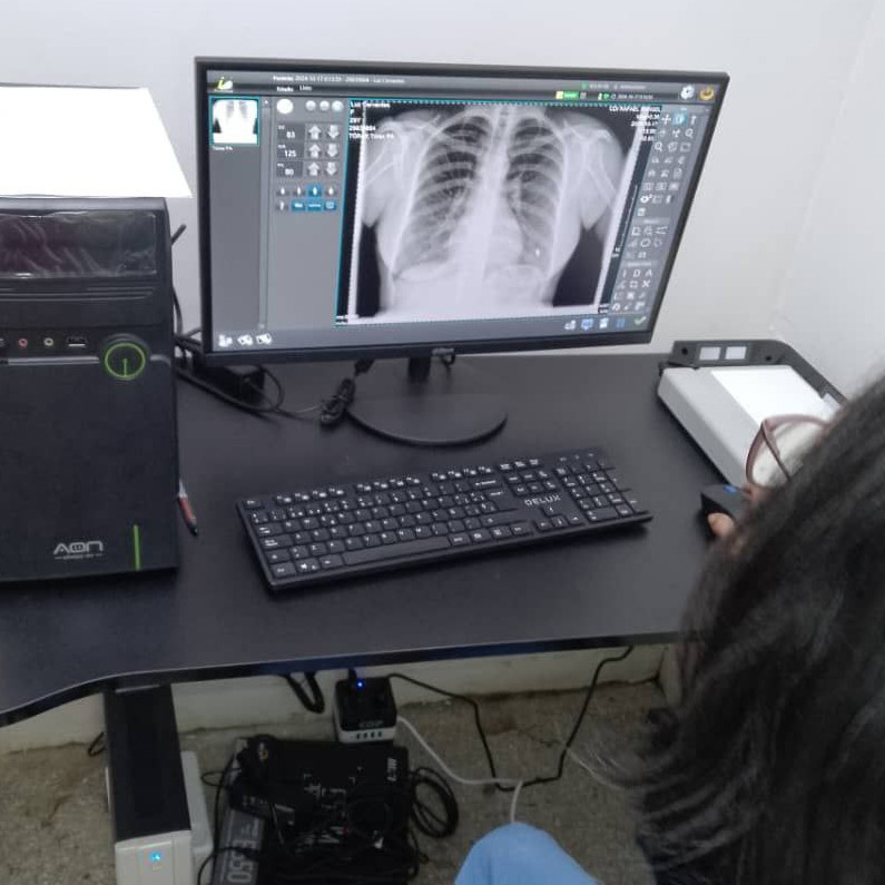 Diario Frontera, Frontera Digital,  Salud, ,Incorporaron equipos de alta tecnología a hospitales de Mérida