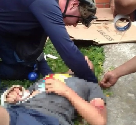 Diario Frontera, Frontera Digital,  Sucesos, ,Adolescente herido tras hecho vial en Mérida