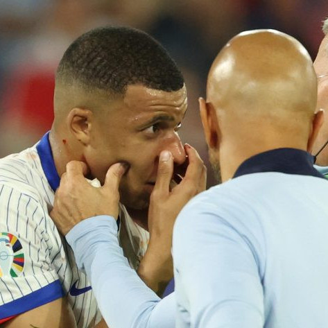 Diario Frontera, Frontera Digital,  Deportes, ,Eurocopa 2024: Mbappé no será operado y jugará con una máscara facial