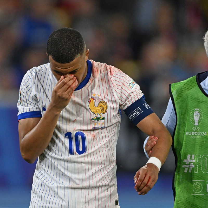 Diario Frontera, Frontera Digital,  Deportes, ,Francia gana, pero Mbappé podría perderse lo que resta de Eurocopa