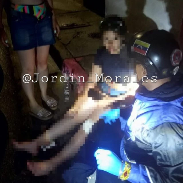 Diario Frontera, Frontera Digital,  Sucesos, ,Conductor y su acompañante resultaron heridos tras vuelco de moto en Los Curos