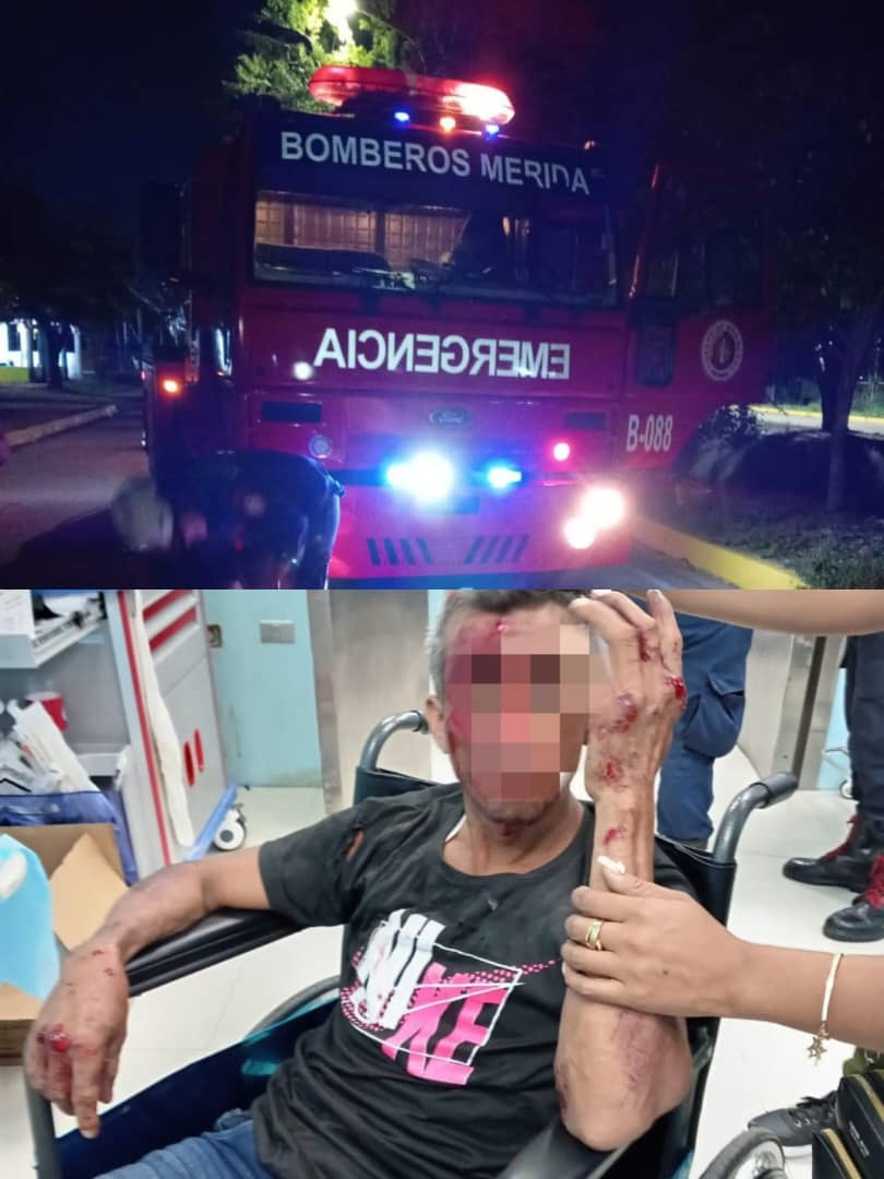 Diario Frontera, Frontera Digital,  Sucesos, ,Motorizado lesionado en vuelco sobre la vía en El Vigía
