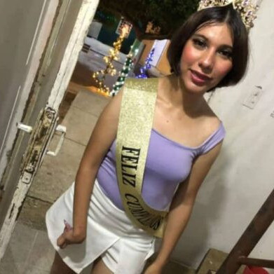 Diario Frontera, Frontera Digital,  Sucesos, ,Murió en el Zulia la joven con discapacidad que resultó quemada por reto de TikTok