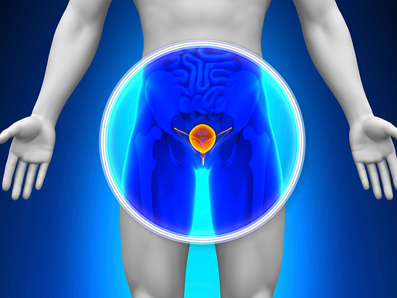 Diario Frontera, Frontera Digital,  Nacionales, Salud, ,Instan a los hombres a realizarse chequeos preventivos contra cáncer de próstata