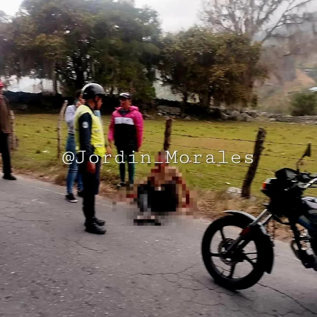 Diario Frontera, Frontera Digital,  Sucesos, ,Arrollaron a un agricultor en Tabay