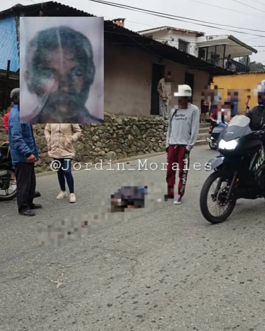 Diario Frontera, Frontera Digital,  Sucesos, ,Septuagenario murió al ser arrollado por un motorizado en la Trasandina