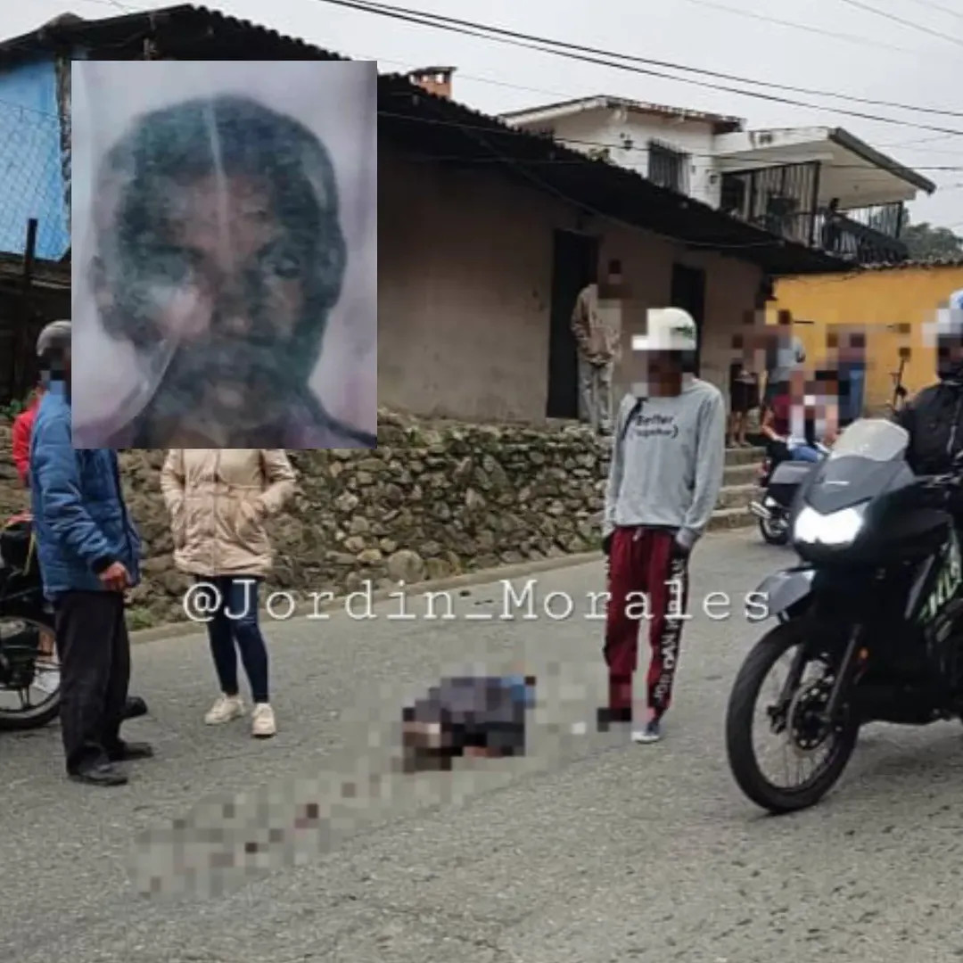 Diario Frontera, Frontera Digital,  Sucesos, ,Septuagenario murió al ser arrollado por un motorizado en la Trasandina