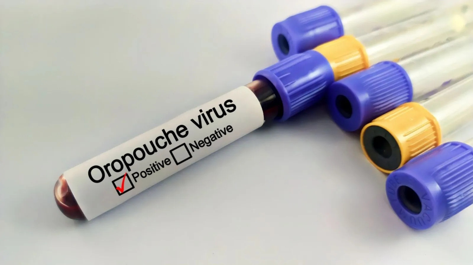 Diario Frontera, Frontera Digital,  Salud, ,Confirmaron cinco casos del virus Oropouche en Venezuela: ¿cómo se contagia y cuáles son sus síntomas?