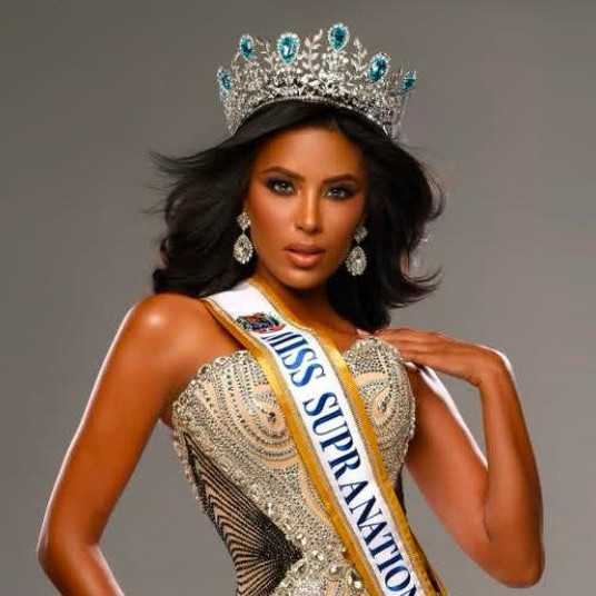 Diario Frontera, Frontera Digital,  Farándula, ,Leix Collins hace historia al coronarse como la primera Miss Supranational Venezuela con espectro autista