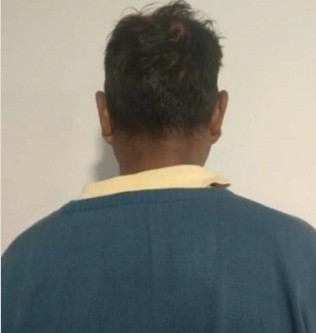 Diario Frontera, Frontera Digital,  Sucesos, ,Cicpc capturó ciudadano solicitado por el delito de lesiones