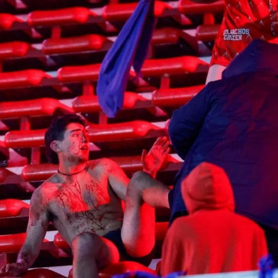 Diario Frontera, Frontera Digital,  Deportes, ,Octavos de la Copa Suramericana terminan en desgracia en Argentina: 10 heridos y 90 detenidos