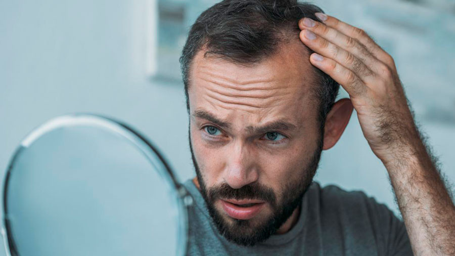 Diario Frontera, Frontera Digital,  Salud, ,Estas bebidas podrían acelerar la pérdida del cabello 
y el encanecimiento prematuro