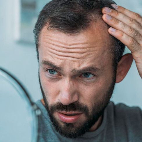 Diario Frontera, Frontera Digital,  Salud, ,Estas bebidas podrían acelerar la pérdida del cabello 
y el encanecimiento prematuro