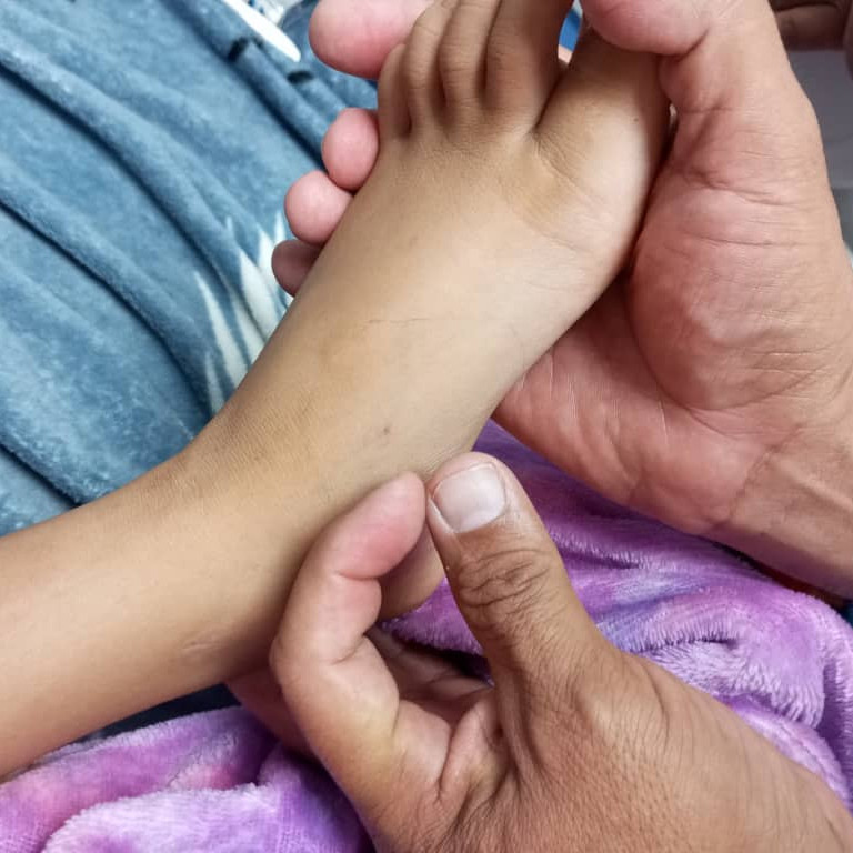 Diario Frontera, Frontera Digital,  Regionales, ,Otro caso de mordedura por serpiente coral en paciente pediátrico es salvado en el Iahula