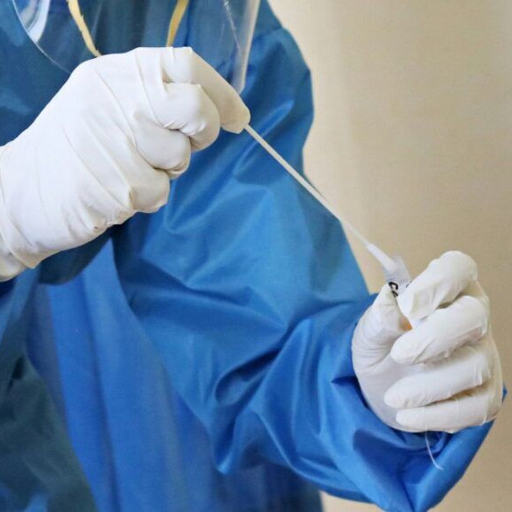 Diario Frontera, Frontera Digital,  Nacionales, Salud, ,Ministerio de Salud confirmó tres muertes por hantavirus en Anzoátegui y descartó contagio entre personas